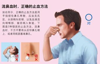 流鼻血怎么能快速止血，鼻出血的正確止血方法